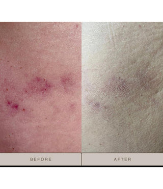 Better aging body lotion before and after comparison