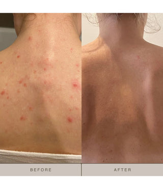 Purity body lotion before and after comparison