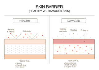 skin barrier